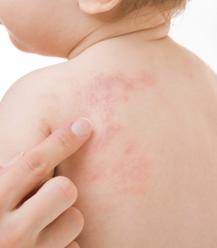 Dermatologia